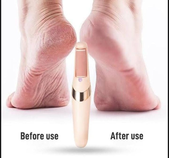 Electric Callus Remover for Feet – Rechargeable Pedicure Tool for Dry, Cracked Heels & Dead Skin