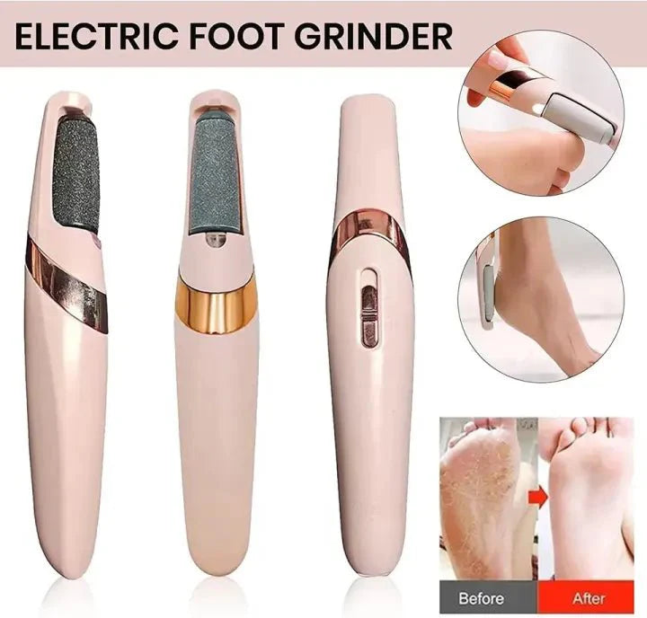 Electric Callus Remover for Feet – Rechargeable Pedicure Tool for Dry, Cracked Heels & Dead Skin