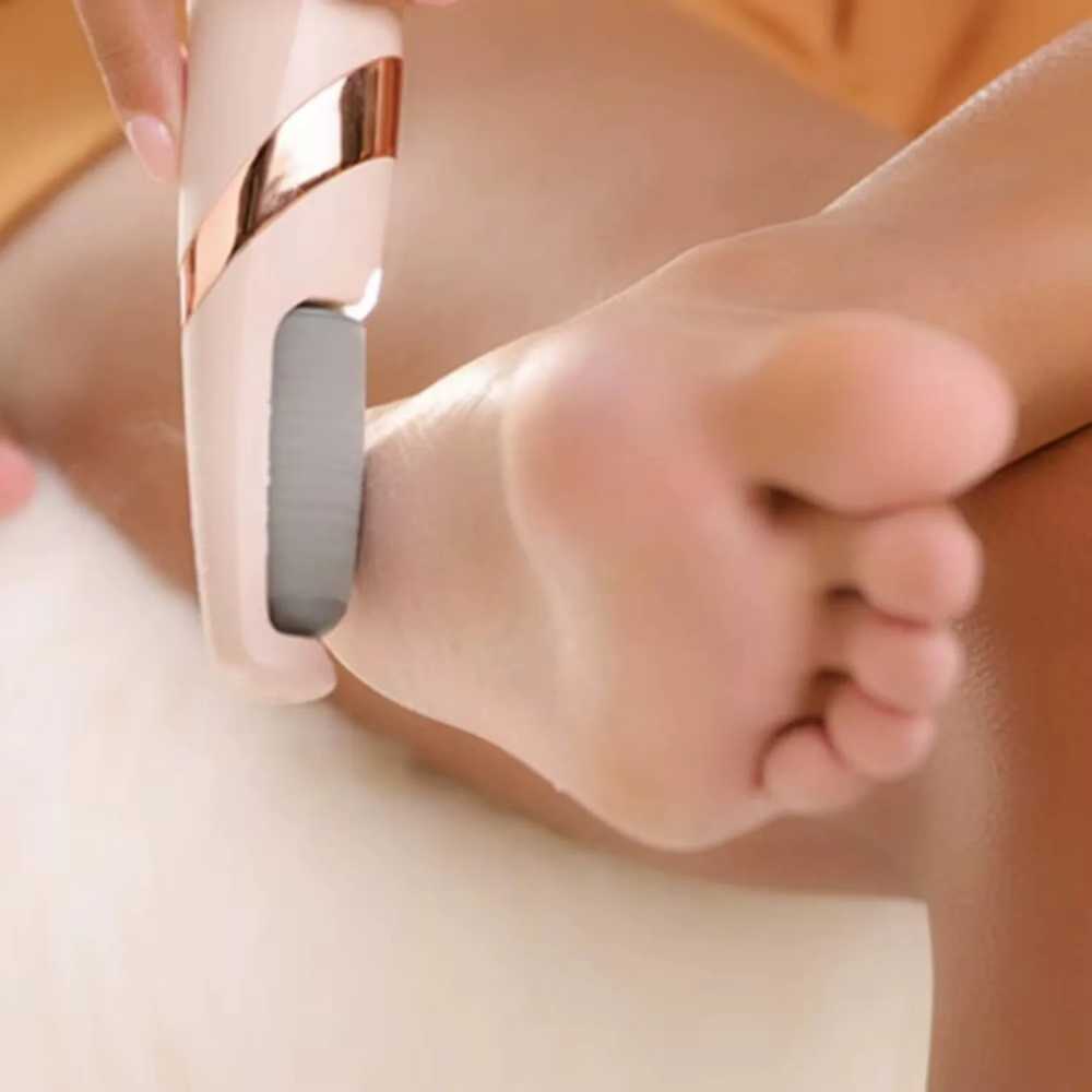 Electric Callus Remover – Rechargeable Foot & Hand Skin Care Tool